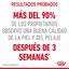 85 g Royal Canin Intense Beauty gelatina sobre para gatos, , large indicador imagen numero 4