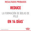 10 kg Royal Canin Intense Hairball pienso para gatos, , large indicador imagen numero 5